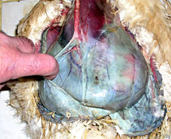 pr&eacute;sence d'ascite