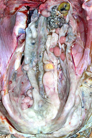 intestin et oviducte