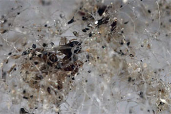 Excr&eacute;ments dans de la fibre