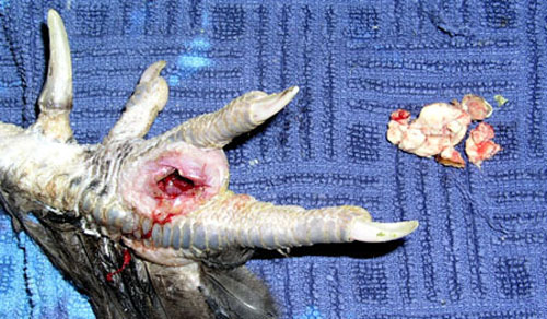 Extraction de pus solide.