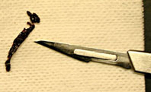 Echarde enlev&eacute;e