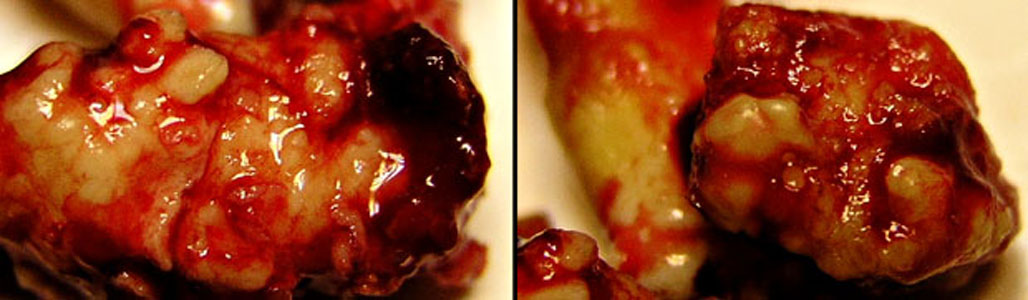 Le volume enlev&eacute;.