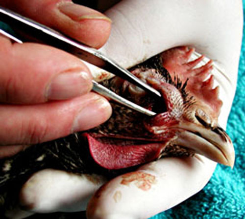 Extraction d'une tumeur.