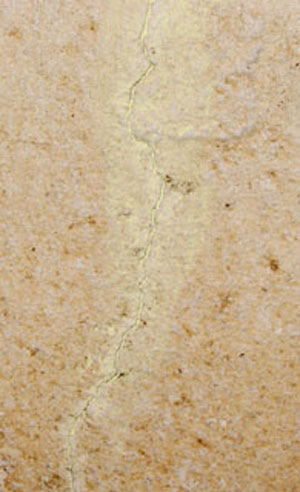 Traitement &agrave; la lotion.