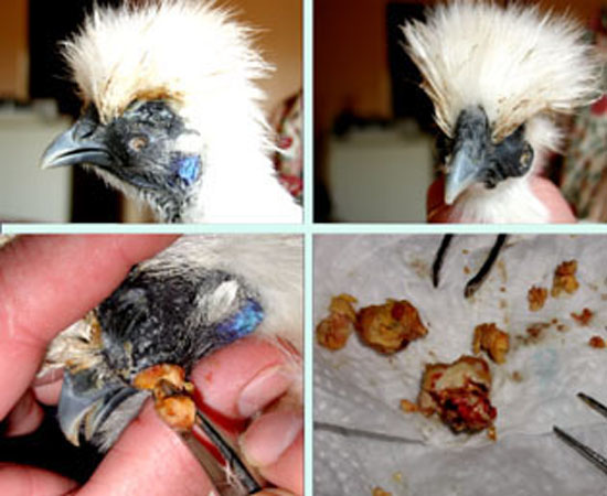 Ablation d'une tumeur.