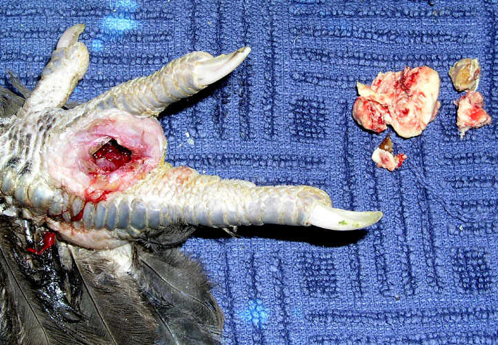 Excision d'une fistule.