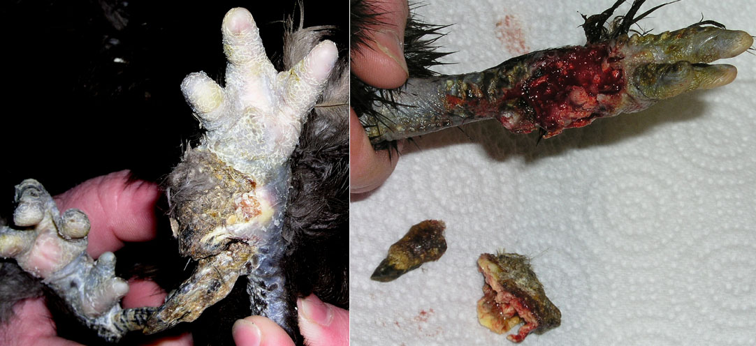 Amputation spontan&eacute;e et ablation d'un abc&egrave;s