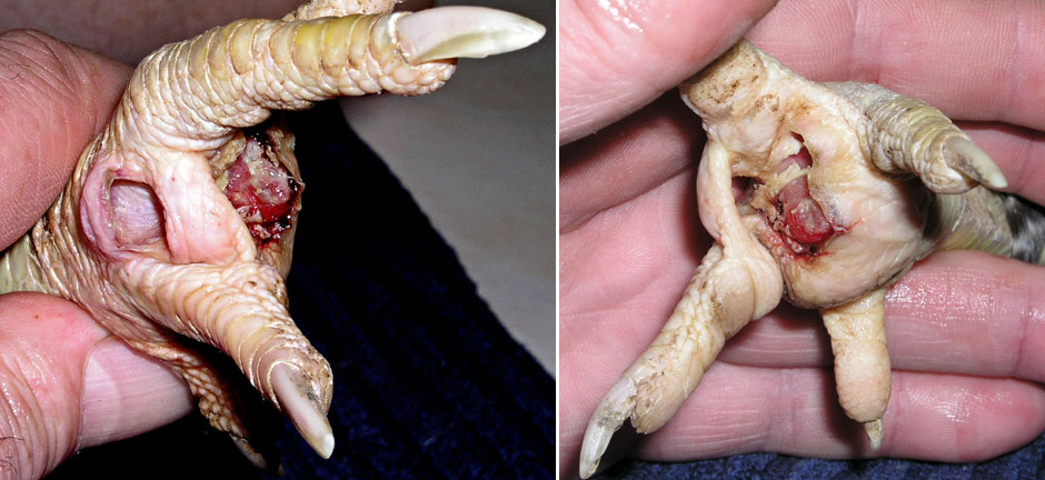 Les abcès sont excisés et les plaie nettoyées. Excision des abcès.